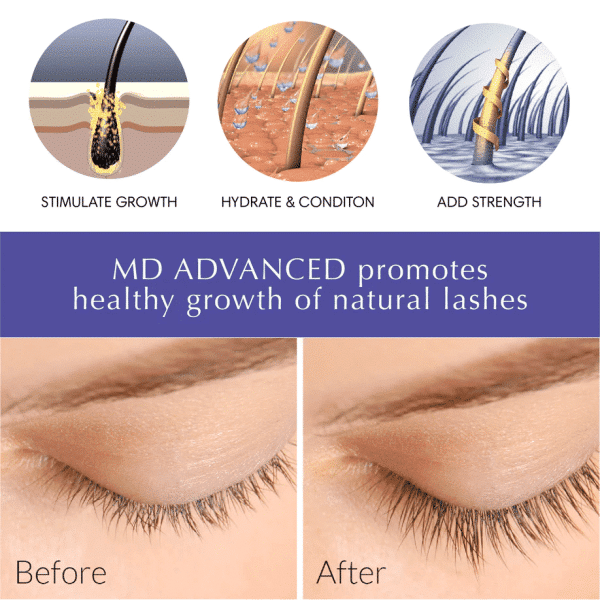 MD Advanced Eyelash Growth Serum